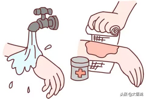 烧伤怎么急救流程,烧伤急救原则中正确的做法是什么