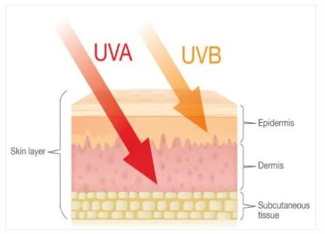 紫外线治疗白癜风会发黑发红吗,白癜风患者怎样预防紫外线