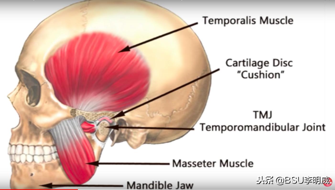 牙咬肌疼的张不开嘴怎么缓解,牙痛咬肌酸痛怎么回事