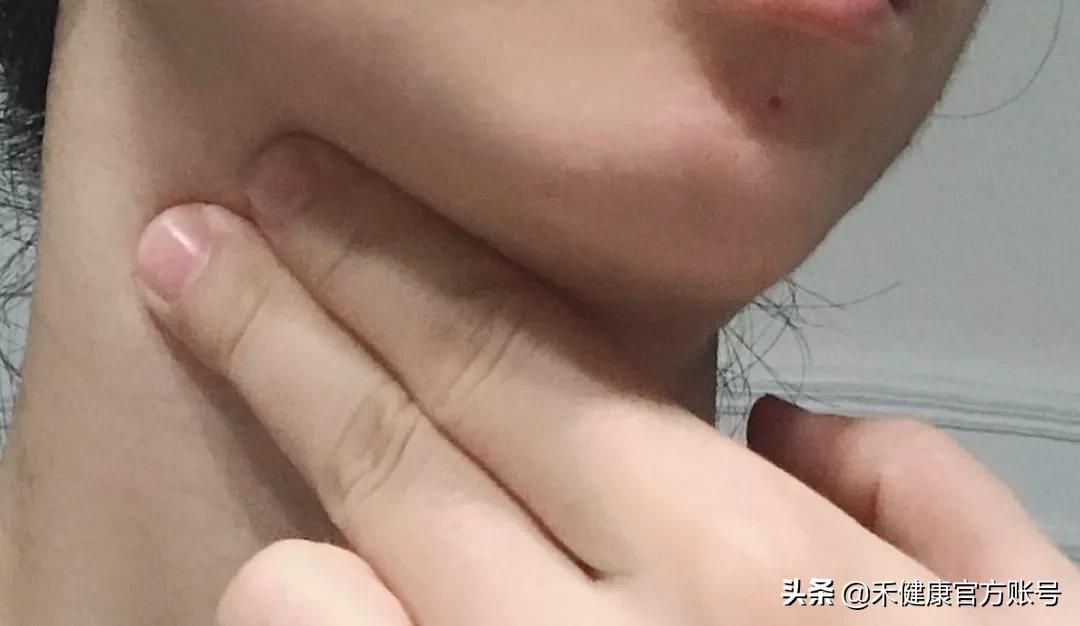 气色差怎么快速恢复气色,气色太差了怎么办