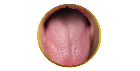 如何通过舌苔判断宝宝健康,中医教你从14种舌头的舌象看健康