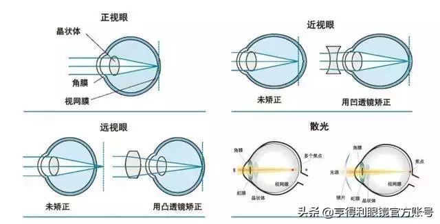 亨得利眼镜无框,亨得利眼镜可以免费换镜片吗