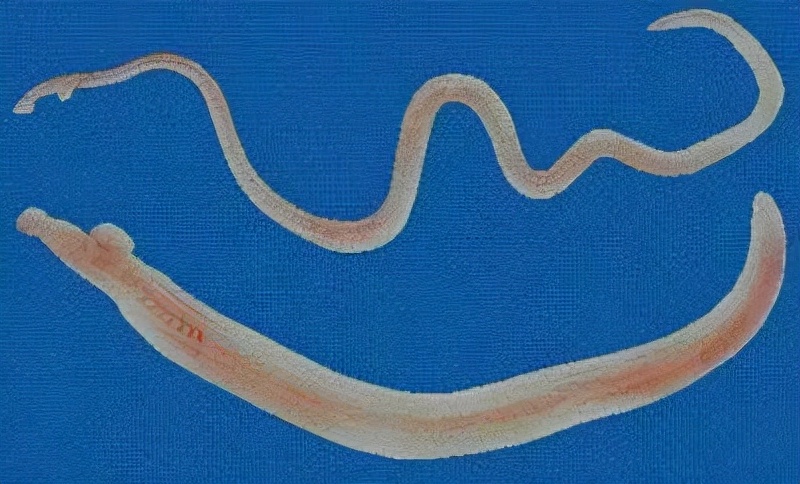 肛门瘙痒警惕四种原因,肛门瘙痒是什么原因有哪些危害