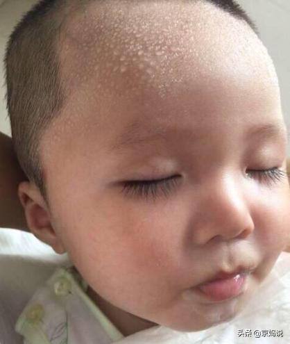 三个月宝宝老是头上出汗,3个月宝宝总是一头汗怎么处理