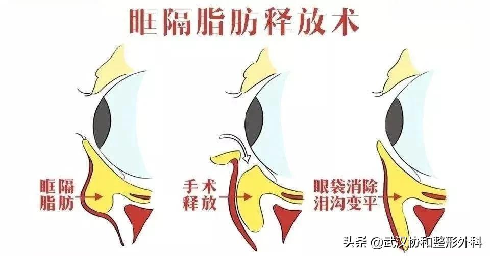 上海九院整形和协和整形,北京协和整形医院美容整形价格