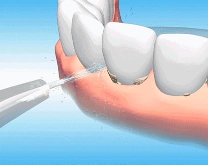 中老年人牙齿松动发黄,中老年人牙齿松动疼痛用什么牙膏