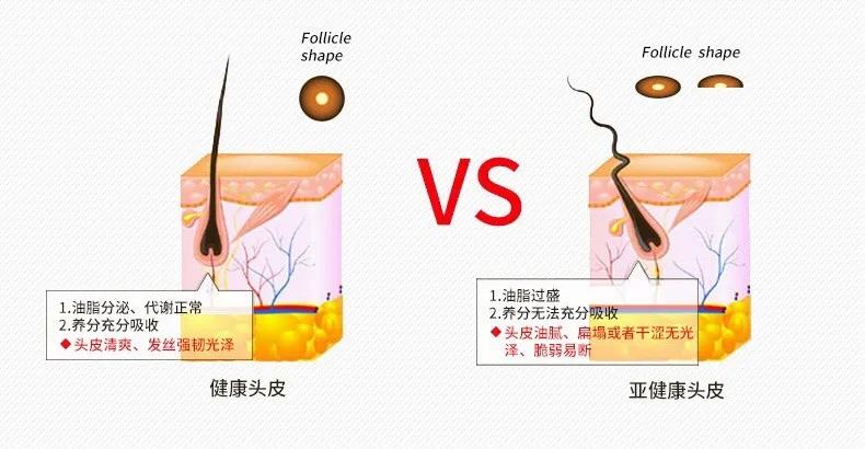 蒙古洗发水,日本洗发水蒙琉怎么样