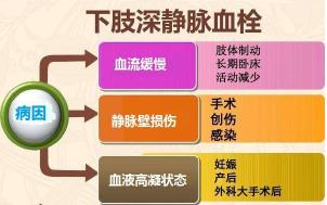 名医专访|深圳市罗湖区人民医院黄智勇：什么是深静脉血栓？