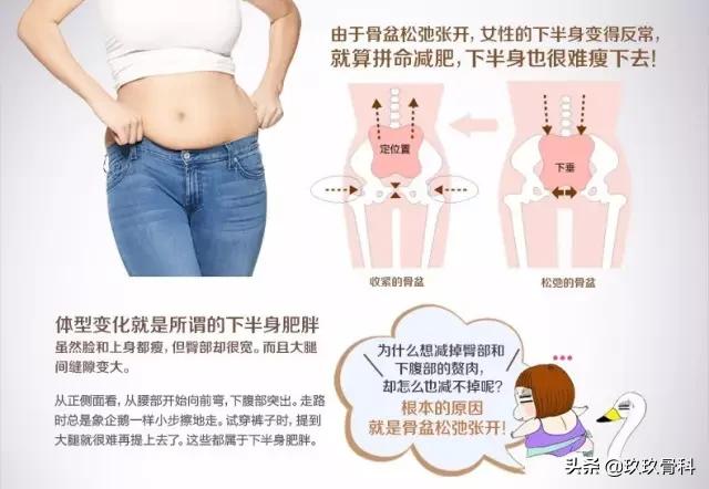 骨盆那些事儿：骨盆错位是女性疾病根源