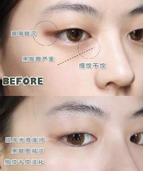 hr赫莲娜绿眼霜,赫莲娜精华眼霜怎么样