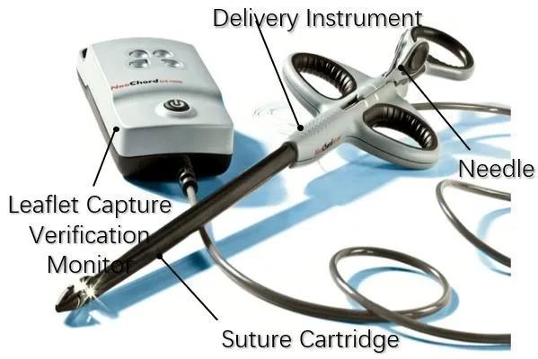 心脏“小门”关不严,经导管二尖瓣介入治疗,不开胸就换瓣