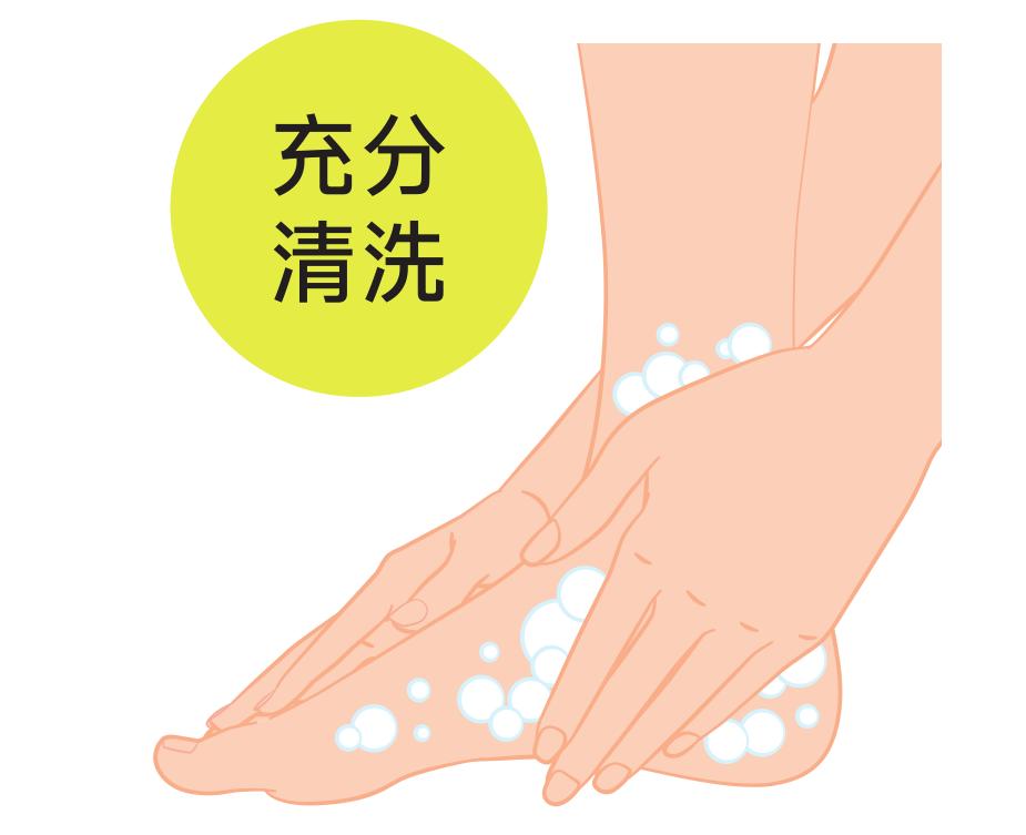 脚底的老茧怎么才能根治,老茧下的鸡眼