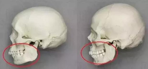 女人法令纹怎么改善,女生长法令纹怎么安慰