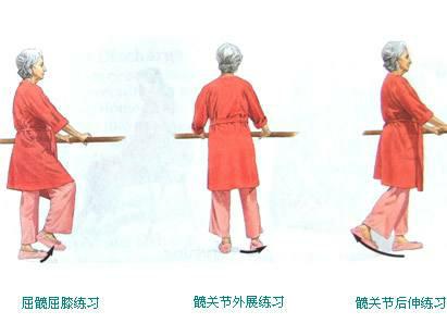 人工关节置换术后康复训练,股骨颈骨折人工置换术后康复训练