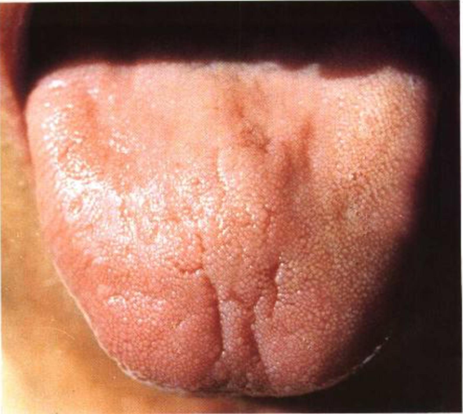 如何从舌苔判断健康,怎样通过舌苔颜色判断身体状况