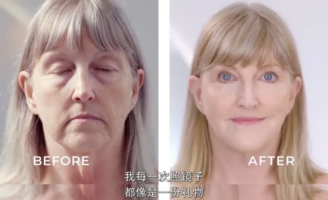 整容能弄成明星的样子吗,整容真的能整漂亮吗