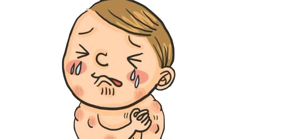 荨麻疹为什么会成癣,为啥得了荨麻疹好些的地方也会痒