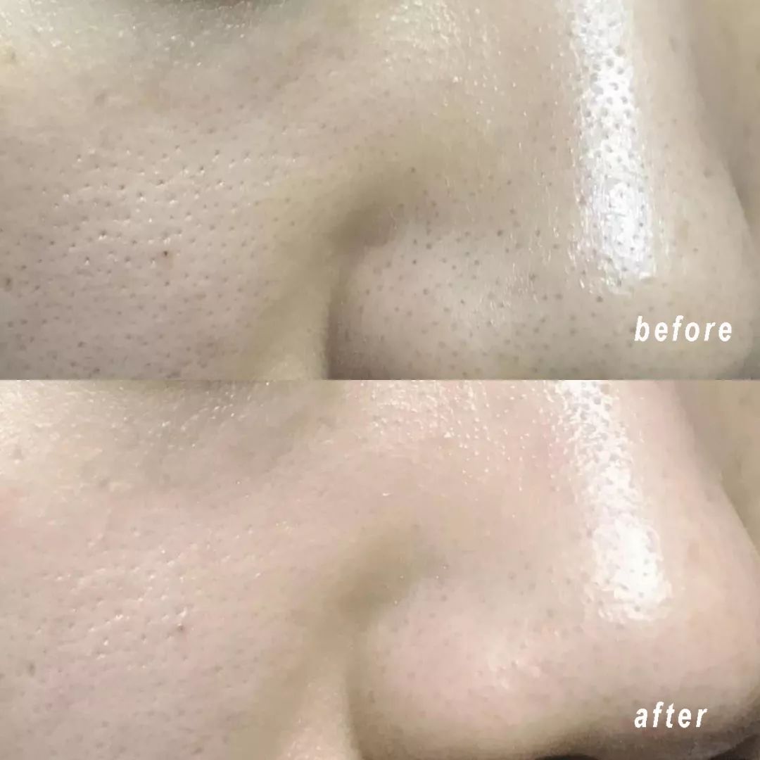 清洁面膜测评,清洁面膜测评打假