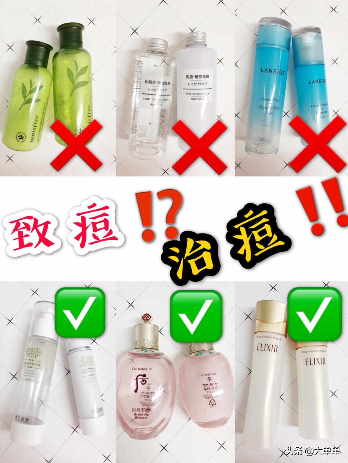 哪些可以改善痘痘闭口的水乳,拒绝痘痘的护肤方法