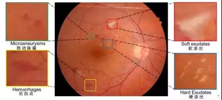 每日ai智能优化,人工智能ai实时翻译应用