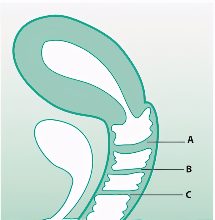 突然开始痛经可能是什么造成,痛经是子宫不健康吗