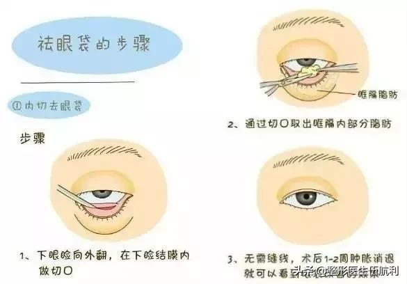 眼睛小应该做哪些眼综合手术,眼睛不对称怎么矫正医美