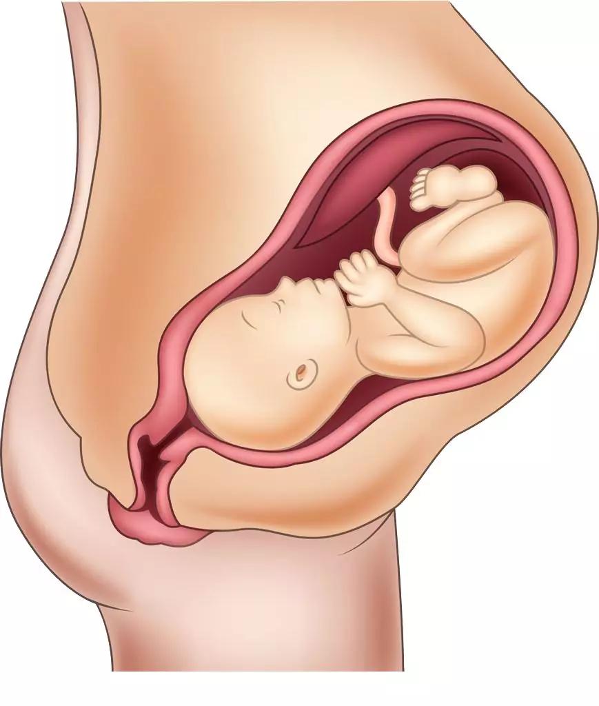 耻骨联合分离产后可以绑着睡觉吗,孕期耻骨联合分离缓解办法