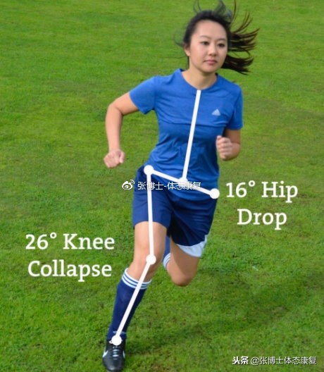 「译文分享」预康复：前交叉韧带损伤的康复训练方法