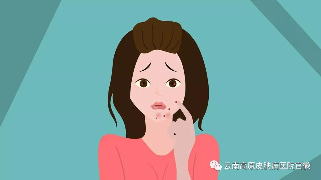 脸上长疮又脱皮怎么回事,脸上长了粒大疮什么原因引起的呢