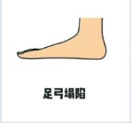 年龄大了穿鞋磨脚侧面,年龄大了穿鞋累脚