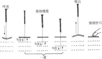 三衢杨氏补泻（十二字分次第手法及歌）