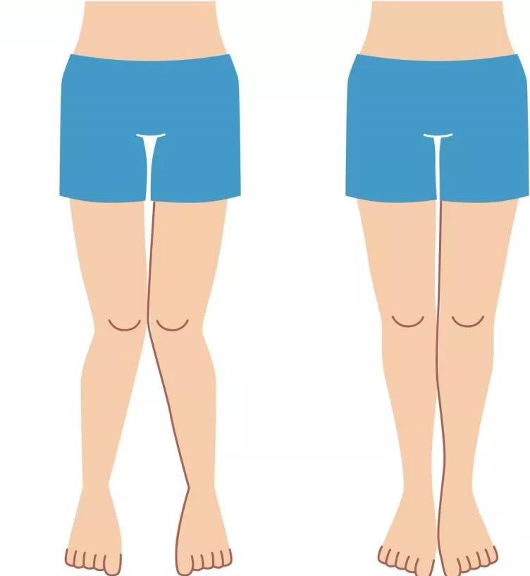 怎么判断深蹲膝盖有没有内扣,深蹲怎么才能不膝盖内扣