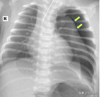 医生需要掌握：针灸治病容易导致的8种异常情况