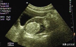 男人也有孕反应腰酸吗,男人也怀孩子