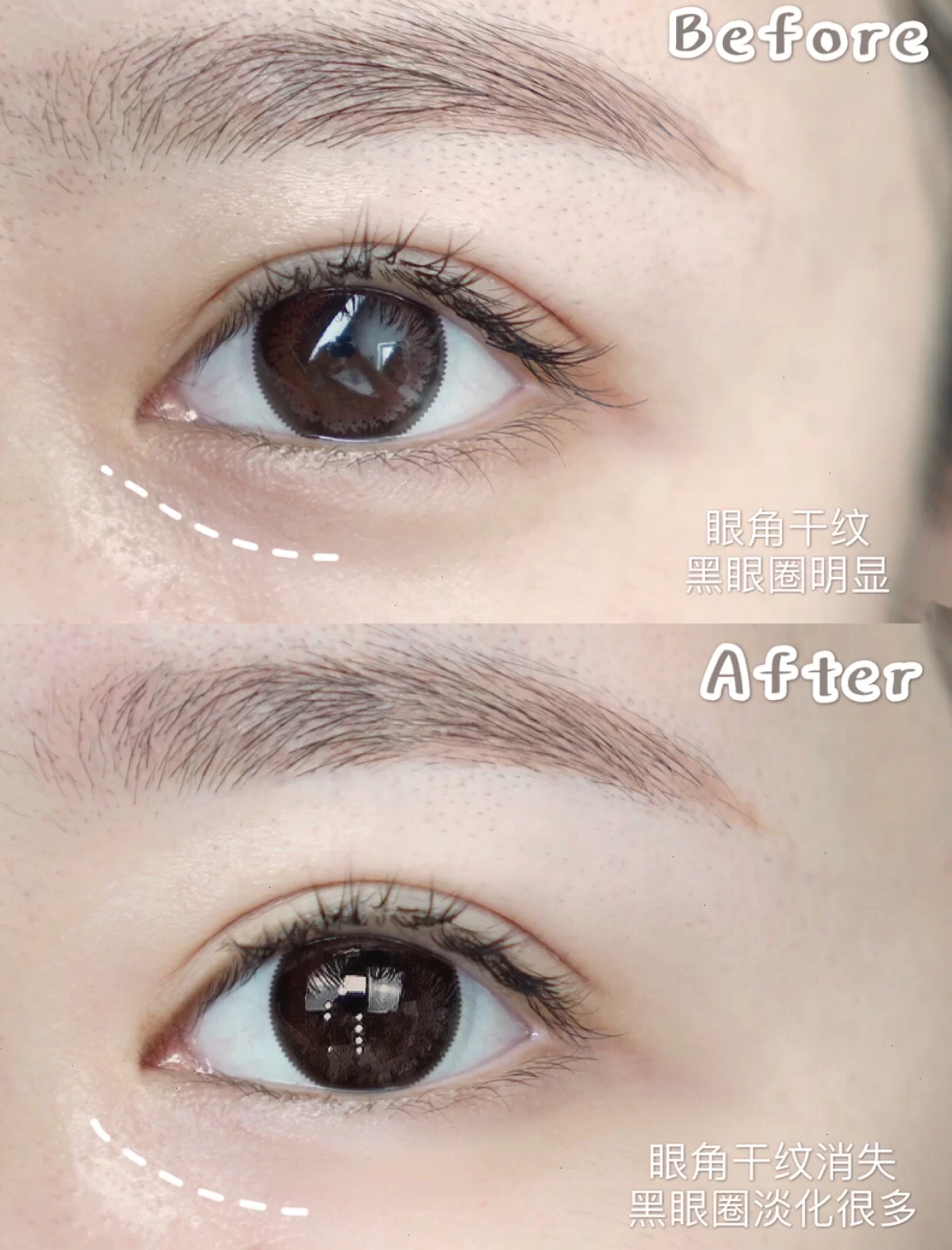 好用的消除黑眼圈的平价眼霜,淡化黑眼圈的平价眼霜推荐