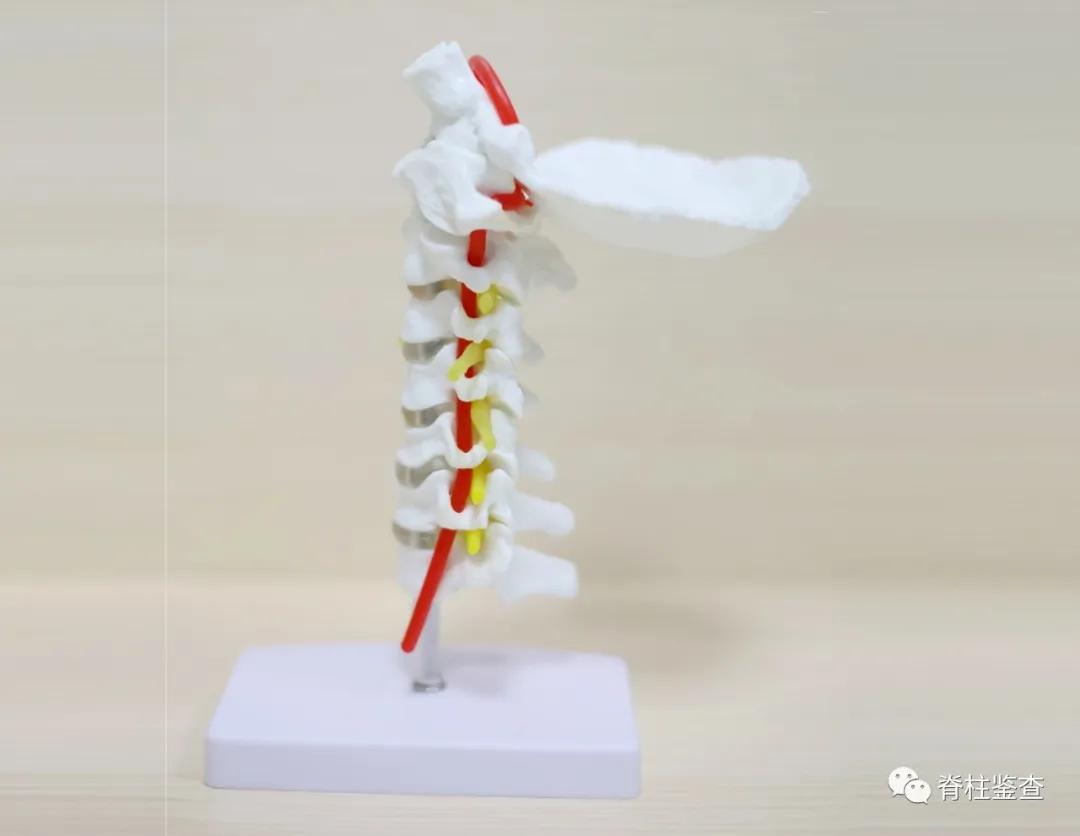 颈椎曲度变直诊断证明,3d演示颈椎生理曲度变直牵引过程