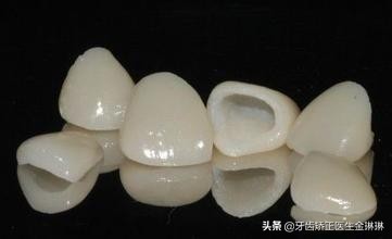 烤瓷牙不密合会导致牙疼吗,烤瓷牙不密合是什么原因引起的