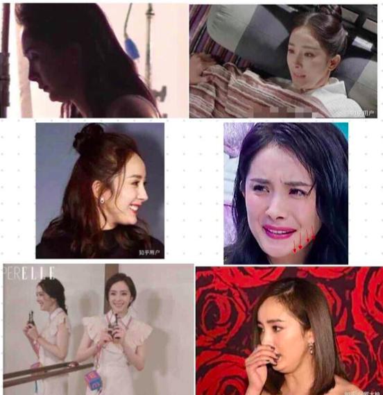 杨幂这些整容后遗症告诉你，不断返厂重修，代价得不偿失