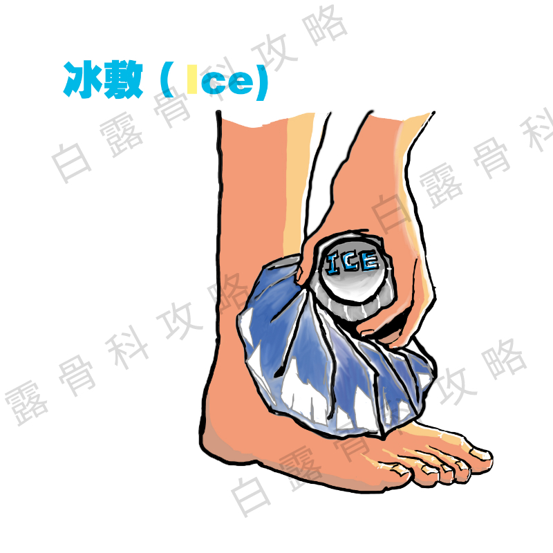 疫情期间崴到脚,在家里面可以这样进行紧急处理