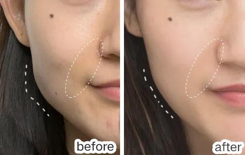 “38岁的年纪,18岁的脸”:能保持年轻的女人,手里少不了它