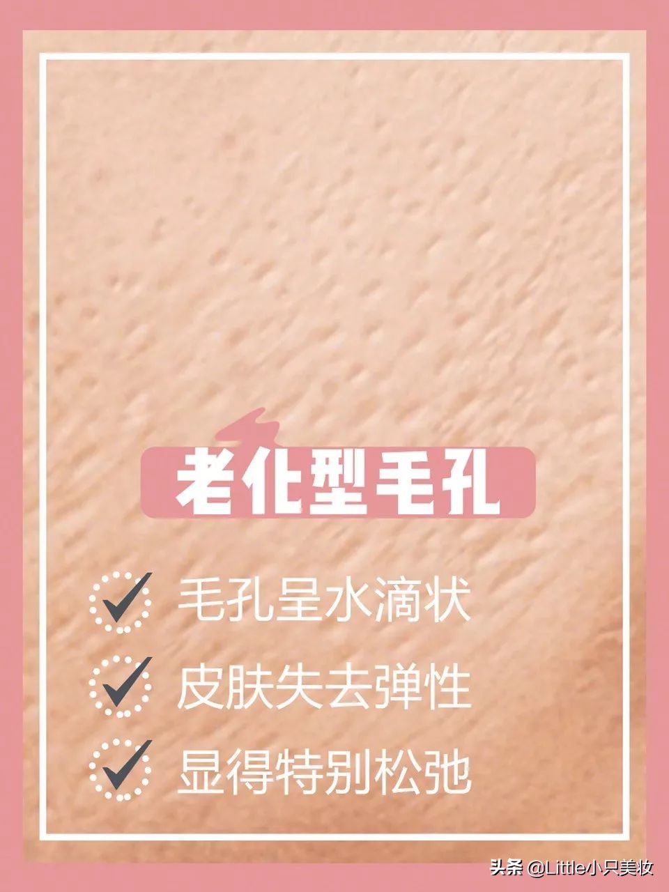 拯救小秘密,拯救毛孔粗大黑头粉刺