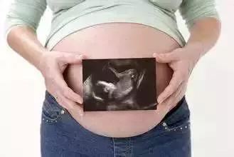 胎儿入盆多久生?怎样判断是否入盆