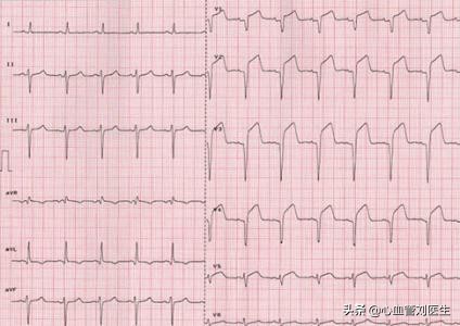 饮酒后胃不适,饮酒后腹痛是什么病