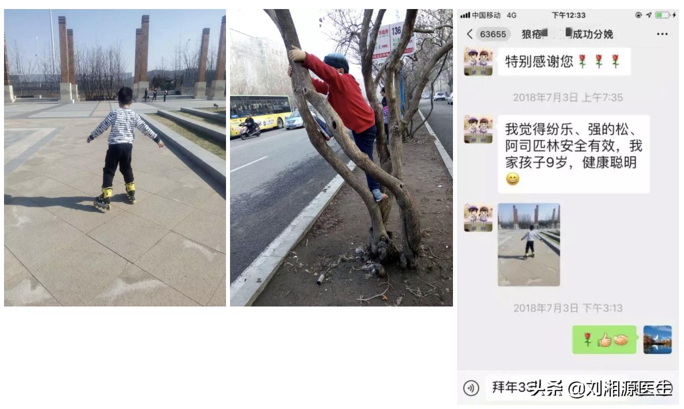 狼疮合并抗磷脂综合症积极治疗后，生下健康宝宝，生二胎则是奢望