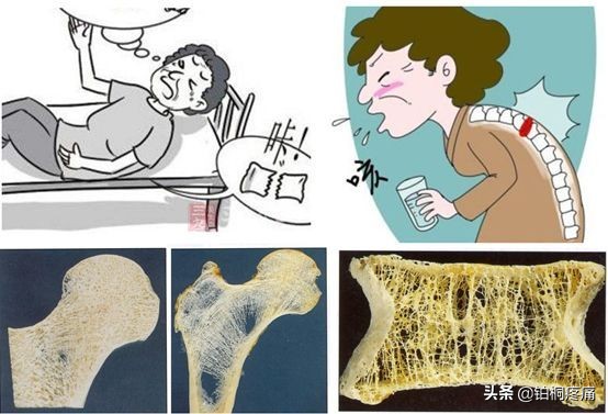 老年人膝盖水肿痛的三大病因,左脚膝盖后面酸痛是什么病因