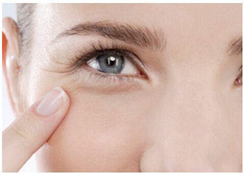 额头眼角皱纹怎么去除,提眉能去除眼角皱纹吗