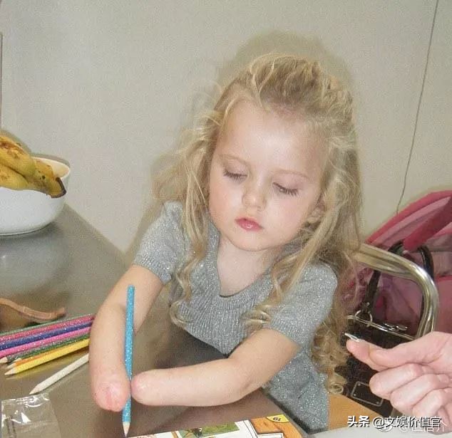 真实版“战斗天使”阿丽塔：13岁机械臂美少女，励志到哭！