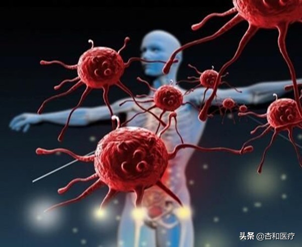 人类治疗癌症的进展情况,全球公认癌症最佳治疗法