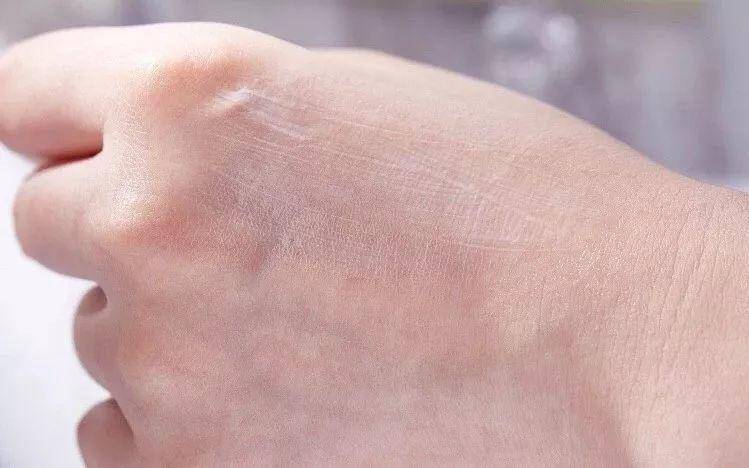 ps去雀斑最有效的小妙招,ps祛雀斑的最佳方法