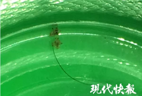 5岁女孩总说眼睛痒，扒开一看竟有二十多只活虱子，十几个虫卵